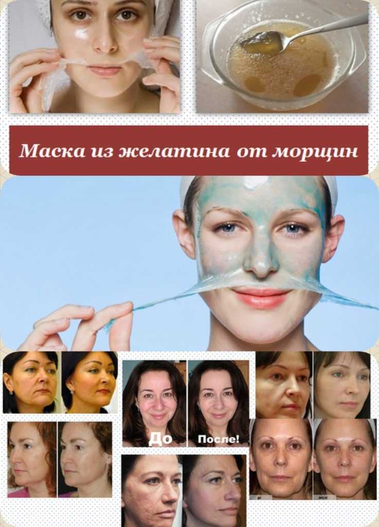 Желатиновые маски для лица | 5 супер рецептов