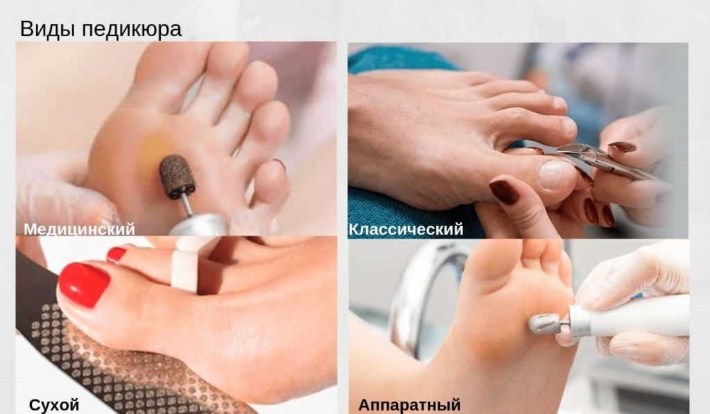 Как правильно делать педикюр в домашних условиях: пошаговое фото — женский сайт краснодара women93.ru, новости, афиша, мероприятия