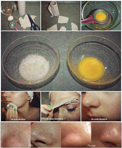 Маска для лица с белком яйца подтягивающая в домашних условиях от морщин для сухой кожи