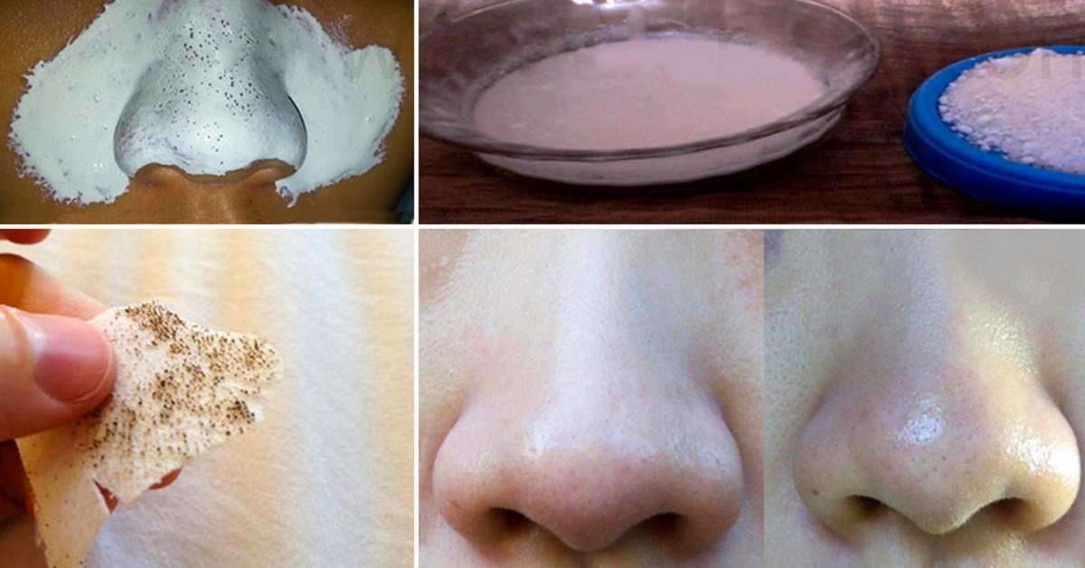 Как сделать лицо бледное в домашних условиях. как сделать свою кожу бледной? | школа красоты
