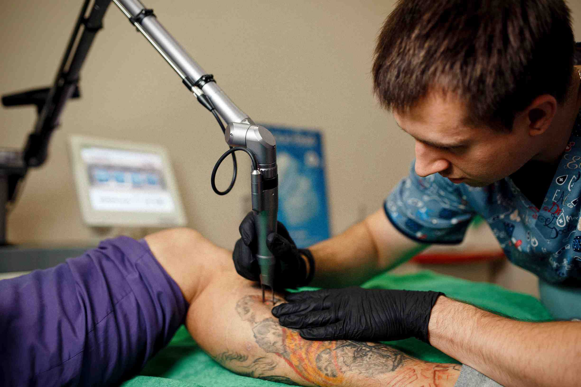 Лазеры для удаления татуировок и перманентного макияжа