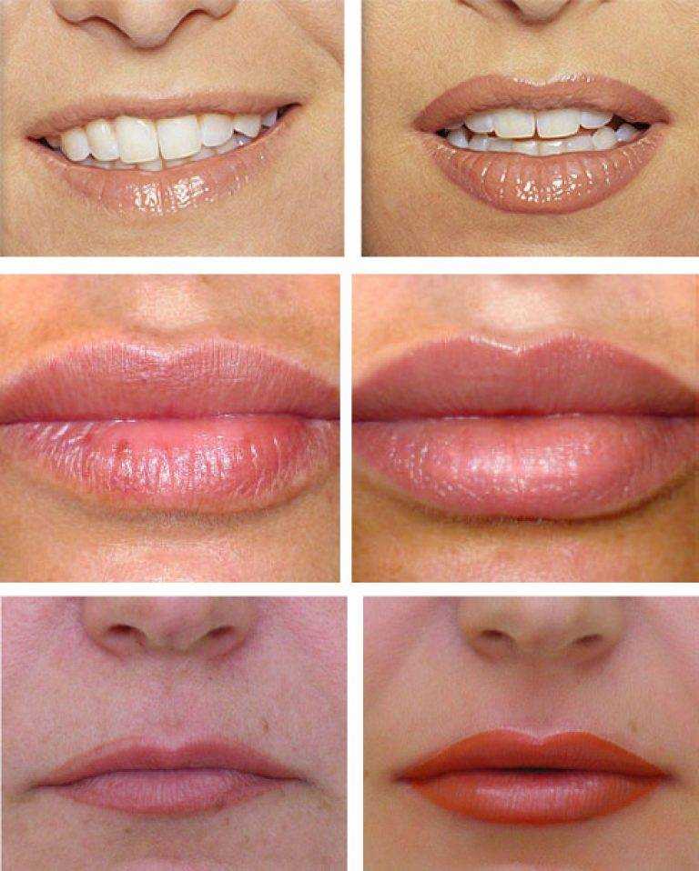 Симметричные губы правильной формы, достаточно пухлые и соблазнительные – мечта каждой женщины Микроблейдинг губ позволит добиться этого в кратчайший срок