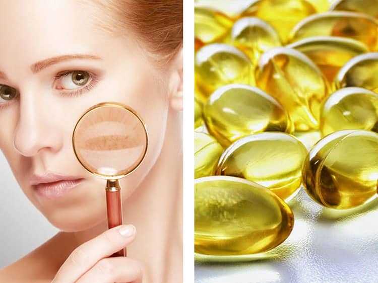Витамин А для лица может приносить как пользу от применения, так и вред Рецепты масок с витамином А для кожи лица А также использование в чистом виде